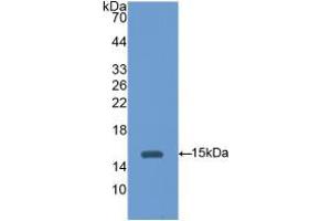 Western blot analysis of recombinant Mouse HEXb. (HEXB antibody  (AA 101-217))