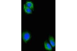 Immunofluorescent analysis of HepG2 cells using ABIN7175061 at dilution of 1:100 and Alexa Fluor 488-congugated AffiniPure Goat Anti-Rabbit IgG(H+L) (C5orf51 antibody  (AA 8-152))