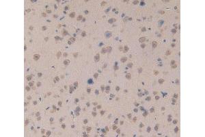 Used in DAB staining on fromalin fixed paraffin- embedded brain tissue (PKC mu antibody  (AA 349-612))
