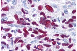 Glioblastoma (GLI3 antibody  (AA 41-57))