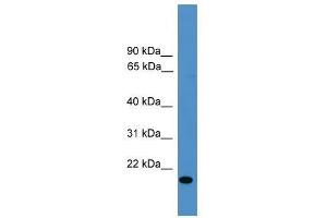 VEGFB antibody used at 0. (VEGFB antibody  (Middle Region))