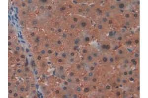 IHC-P analysis of Human Liver Tissue, with DAB staining. (ARIP4 antibody  (AA 638-837))