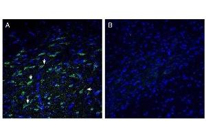 Expression of ZnT10 in rat basal ganglia. (Solute Carrier Family 30, Member 10 (SLC30A10) Peptide)
