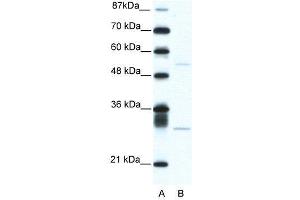 WB Suggested Anti-ATF4  Antibody Titration: 5. (ATF4 antibody  (C-Term))