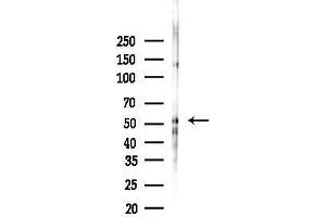 Western blot analysis of lysates from Mouse brain, using Phospho-Parkin (Ser378) Antibody at 1/1000 dilution.