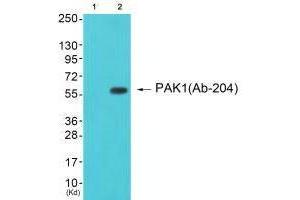 Western blot analysis of extracts from cos-7 cells (Lane 2), using PAK1 (Ab-204) antiobdy. (PAK1 antibody  (Ser204))