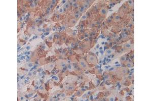 Used in DAB staining on fromalin fixed paraffin- embedded stomach tissue (Neuregulin 2 antibody  (AA 618-836))