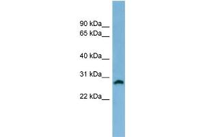 WB Suggested Anti-SRD5A2 Antibody Titration: 0. (SRD5A2 antibody  (N-Term))
