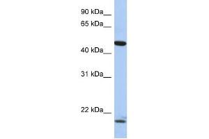 Western Blot showing PLAGL1 antibody used at a concentration of 1-2 ug/ml to detect its target protein. (PLAGL1 antibody  (N-Term))