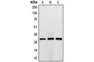 Western blot analysis of TIMP3 expression in HepG2 (A), HeLa (B), NIH3T3 (C) whole cell lysates.