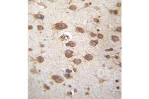 Formalin fixed and paraffin embedded human brain tissue stained with STAP2 Antibody (Center) followed by peroxidase conjugation of the secondary antibody and DAB staining. (STAP2 antibody  (Middle Region))