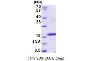 SDS-PAGE (SDS) image for RNA Binding Motif Protein 3 (RBM3) (AA 1-157) protein (His tag) (ABIN5852973) (RBM3 Protein (AA 1-157) (His tag))