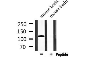 Western blot analysis of extracts from mouse brain, using TRPM8 Antibody. (TRPM8 antibody)