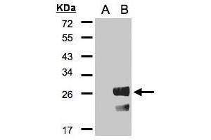 WB Image Western Blot analysis of RGS19 expression in transfected 293T cell line by RGS19 polyclonal antibody. (RGS19 antibody  (C-Term))