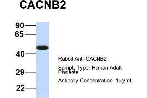 Host:  Rabbit  Target Name:  CACNB2  Sample Type:  Human Adult Placenta  Antibody Dilution:  1. (CACNB4 antibody  (Middle Region))