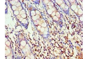 Immunohistochemistry of paraffin-embedded human colon tissue using ABIN7142909 at dilution of 1:100 (AKAP5 antibody  (AA 1-270))