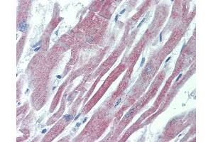Anti-GALR2 antibody IHC of human heart. (GALR2 antibody  (AA 212-277))