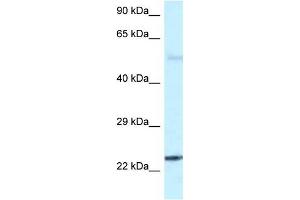 Western Blot showing RAB31 antibody used at a concentration of 1 ug/ml against Fetal Brain Lysate (RAB31 antibody  (C-Term))