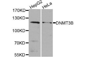 Western blot analysis of extracts of various cell lines, using DNMT3B antibody. (DNMT3B antibody)