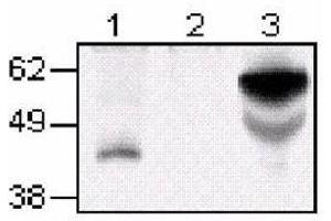 Western Blotting (WB) image for anti-Tumor Necrosis Factor Receptor Superfamily, Member 4 (TNFRSF4) antibody (FITC) (ABIN316461) (TNFRSF4 antibody  (FITC))