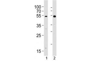 Western blot analysis of lysate from 1) human Raji cell line and 2) rat spleen tissue lysate using Lyn antibody. (LYN antibody  (AA 229-263))