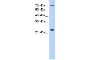 WB Suggested Anti-CLDN2 Antibody Titration:  1. (Claudin 2 antibody  (N-Term))