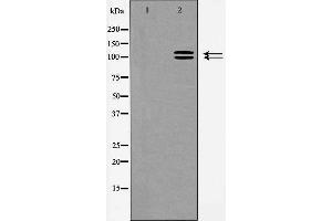 Western blot analysis of ACE2 expression in HeLa cells,The lane on the left is treated with the antigen-specific peptide. (ACE2 antibody  (Internal Region))