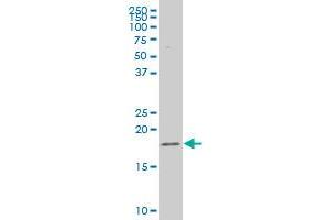 CAV3 polyclonal antibody (A01), Lot # 051108JC01 Western Blot analysis of CAV3 expression in SJCRH30 . (Caveolin 3 antibody  (AA 1-83))