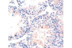 Figure. (RPN1 antibody  (AA 273-518))