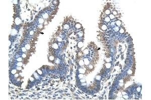 RNF121 antibody was used for immunohistochemistry at a concentration of 4-8 ug/ml to stain Epithelial cells of intestinal villus (arrows) in Human Intestine.