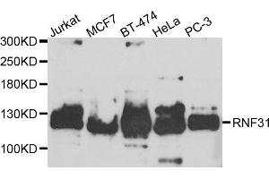 Western blot analysis of extracts of various cell lines, using RNF31 antibody. (RNF31 antibody)
