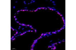Immunofluorescence of paraffin embedded mouse bladder using PRPF4 (ABIN7075312) at dilution of 1: 500 (400x lens) (PRPF4 antibody)