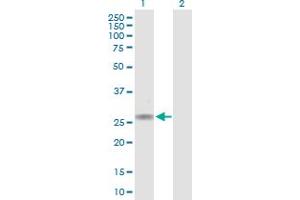 Western Blot analysis of CACNG1 expression in transfected 293T cell line by CACNG1 MaxPab polyclonal antibody. (CACNG1 antibody  (AA 1-222))