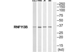 Western Blotting (WB) image for anti-Ring Finger Protein 113B (RNF113B) (Internal Region) antibody (ABIN1852492) (RNF113B antibody  (Internal Region))