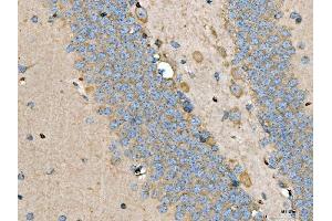 IHC analysis of LARP1 using anti-LARP1 antibody (ABIN7599861).