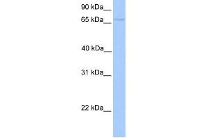 WB Suggested Anti-FOXO1 Antibody Titration:  0. (FOXO1 antibody  (Middle Region))