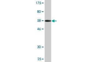 Western Blot detection against Immunogen (56. (XPO5 antibody  (AA 1-280))