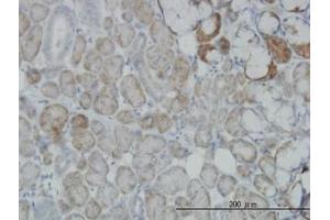 Image no. 6 for anti-Oxidative-Stress Responsive 1 (OXSR1) (AA 1-528) antibody (ABIN599106) (OXSR1 antibody  (AA 1-528))