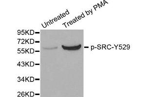 Western Blotting (WB) image for anti-Proto-oncogene tyrosine-protein kinase Src (Src) (pTyr529) antibody (ABIN1870630) (Src antibody  (pTyr529))