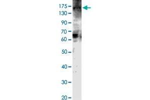Western blot analysis of JMJD2C protein with JMJD2C polyclonal antibody . (KDM4C antibody  (AA 502-520))
