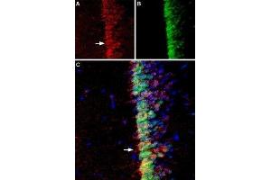 ADCY3 antibody  (3rd Extracellular Loop)