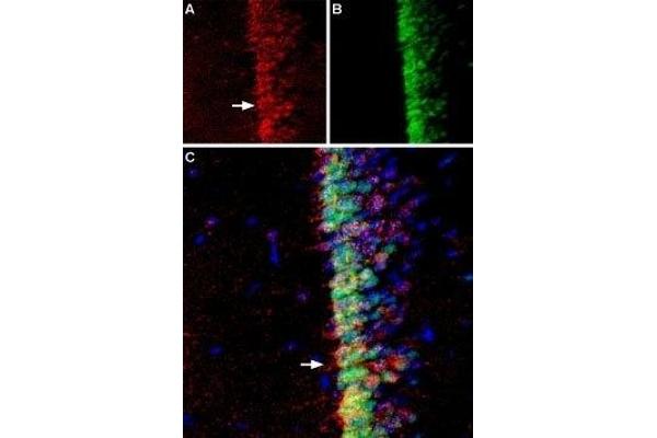 ADCY3 antibody  (3rd Extracellular Loop)