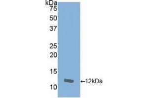 Detection of Recombinant IL8, Equine using Polyclonal Antibody to Interleukin 8 (IL8) (IL-8 antibody  (AA 23-101))