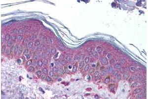 anti-serpin Peptidase Inhibitor, Clade F (Alpha-2 Antiplasmin, Pigment Epithelium Derived Factor), Member 1 (SERPINF1) (N-Term) antibody