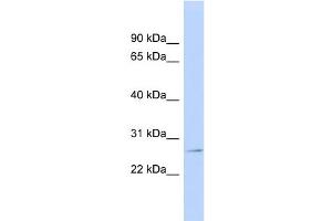 WB Suggested Anti-GSTP1 Antibody Titration:  0. (GSTP1 antibody  (N-Term))