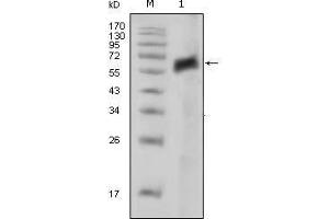 Western blot analysis using AXL mouse mAb against extracellular domain of human AXL (aa19-444).