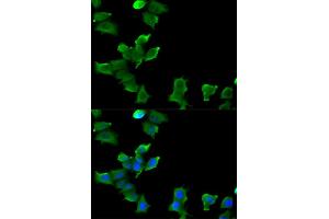 Immunofluorescence analysis of MCF-7 cells using GLUL antibody. (GLUL antibody)