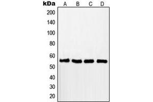 Western blot analysis of RAD18 expression in MCF7 (A), A549 (B), Jurkat (C), HCT116 (D) whole cell lysates. (RAD18 antibody  (Center))
