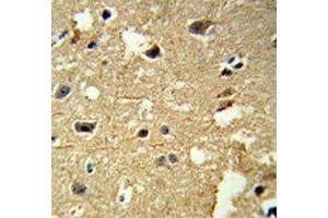 IHC analysis of FFPE human brain tissue stained with anti-beta Tubulin antibody (TUBB1 antibody)