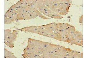 Immunohistochemistry of paraffin-embedded human skeletal muscle tissue using ABIN7160153 at dilution of 1:100 (SLC16A10 antibody  (AA 159-201))